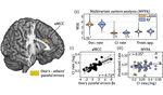 Pain management decisions in emergency hospitals are predicted by brain activity during empathy and error monitoring