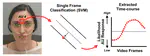 State-specific and supraordinal components of facial response to pain