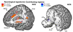 Does inappropriate behaviour hurt or stink? The interplay between neural representations of somatic experiences and moral decisions