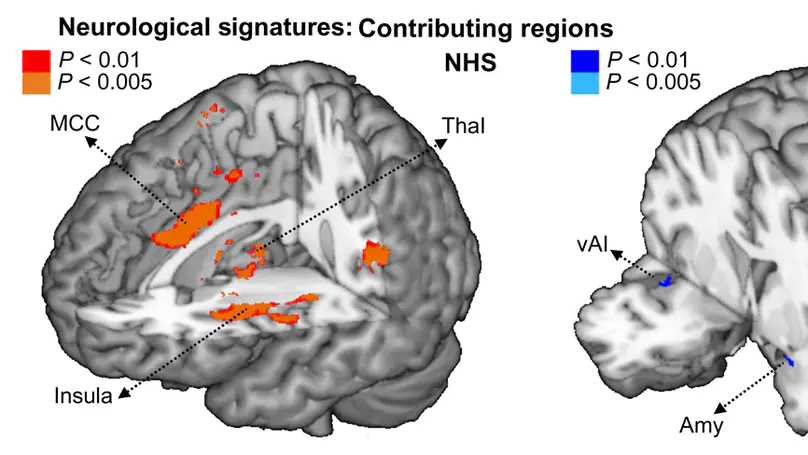 Does inappropriate behaviour hurt or stink? The interplay between neural representations of somatic experiences and moral decisions